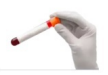 Lab Tests